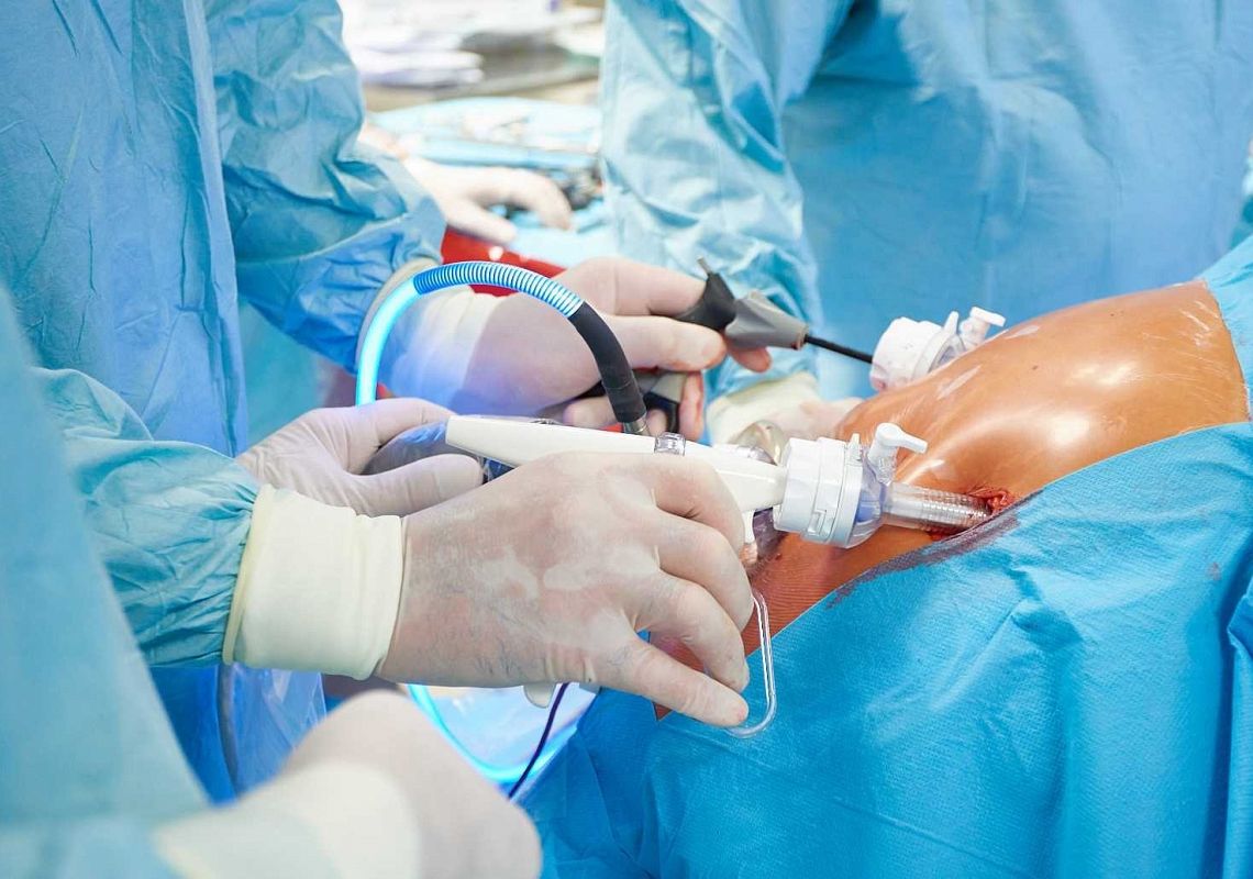 BARIATRIA - LECZENIE OTYŁOŚCI