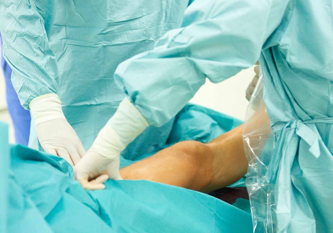 OPERACYJNE LECZENIE ŻYLAKÓW